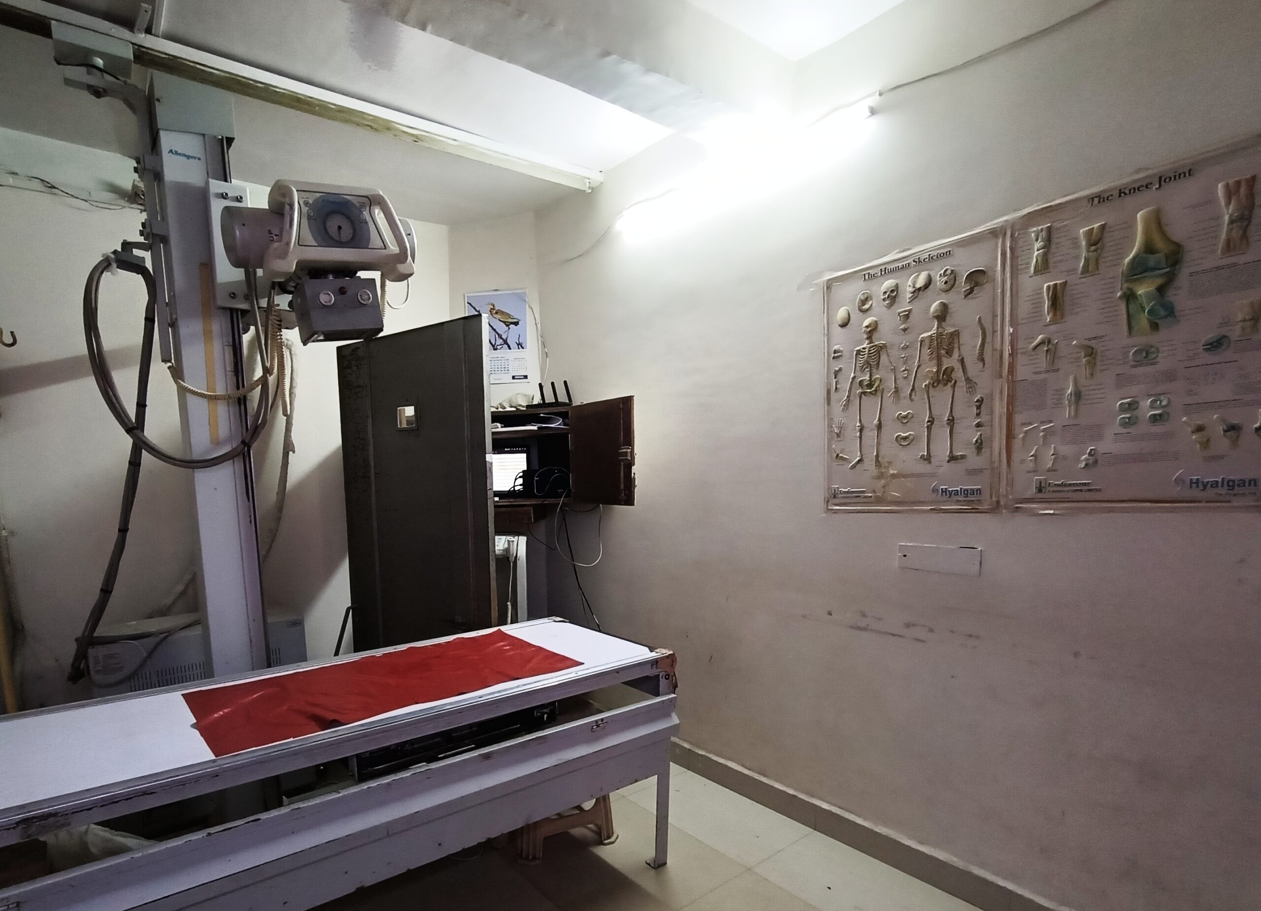 X-Ray